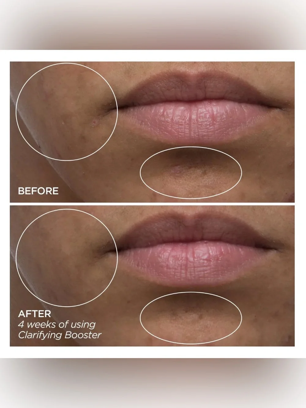 BEAUTYBIO Clarifying Booster - Salicylic Acid Treatment Serum